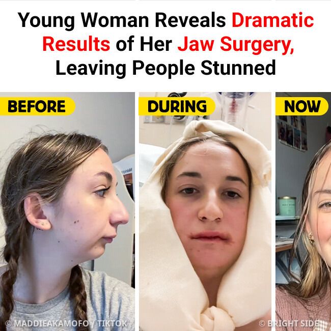 Bailey Rose Spinn Woman Shares Jaw Dropping Transformation The Bailey Rose Spinn Woman Shares Jaw Dropping Transformation The