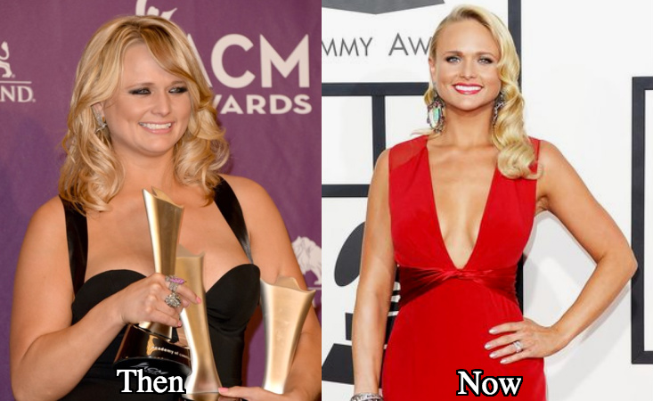 Miranda Lambert Plastic Surgery And Weight Loss Before And After Photos Miranda Lambert Plastic Surgery And Weight Loss Before And After Photos